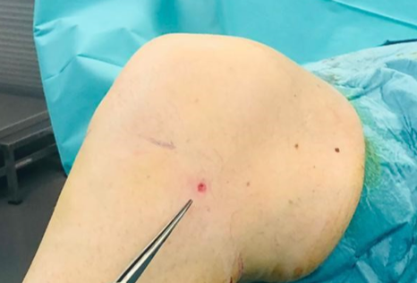 Recover_Knie_1